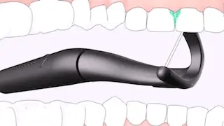 Purefloss™ | Hilo Dental Eléctrico Sónico